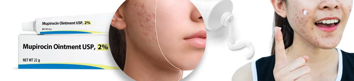 Before and after mupirocin ointment for acne