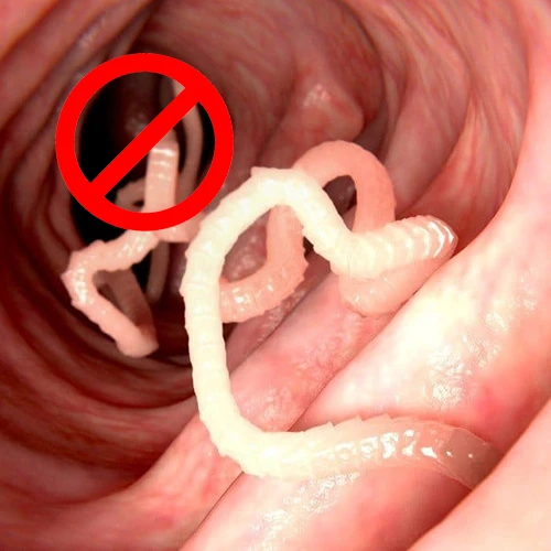 Anti Worm