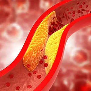 Cholesterol