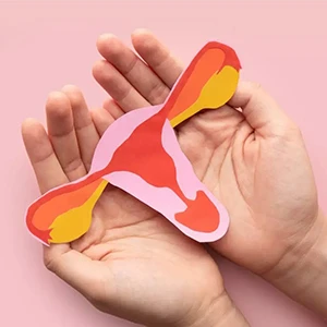 Endometriosis