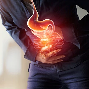 Gastro Esophageal Reflux