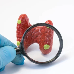 Hyperparathyroidism